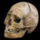 Image for article titled This medical condition turns muscle to bone